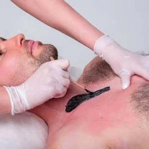 Normal Waxing